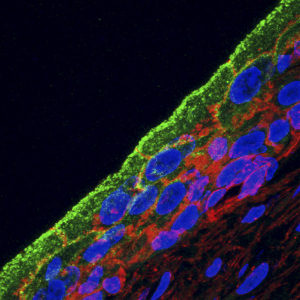Rab11a (green), actin (red), and nuclei (blue) in umbrella cell layer.
