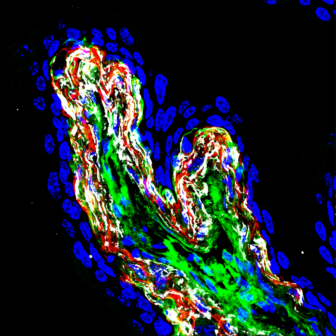 Suburothelial fibroblasts: PDGFRA (green), TNC (red), CAR3 (white) 