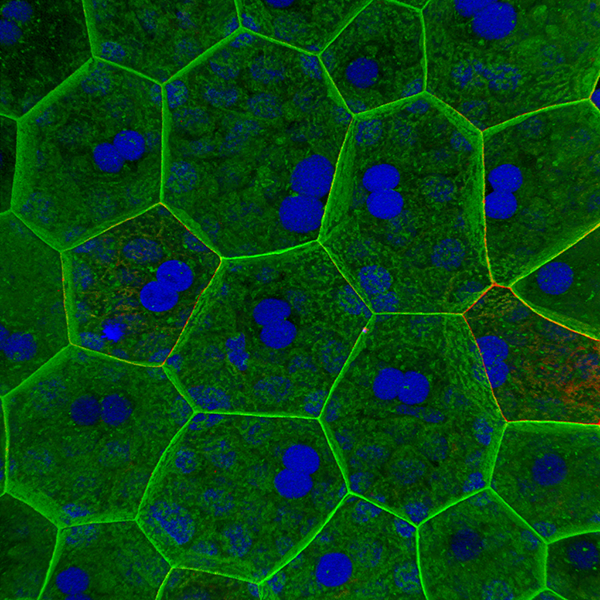 Distribution of E-cadherin (green) and nuclei (blue) in rat umbrella cells