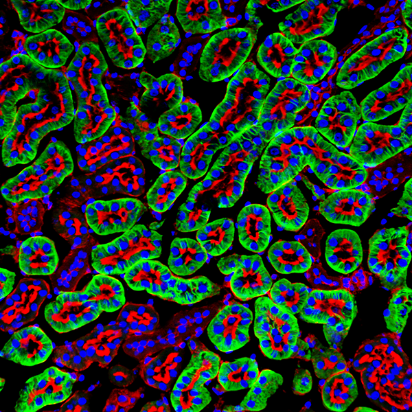 Mouse kidney proximal tubules stained with an antibody to the organic anion tranporter OAT1 (green), rhodamine phalloidin (red), and To-Pro3 (blue)