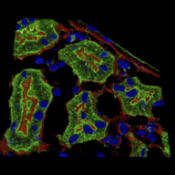 Dab2 (green), actin (red), and nuclei (blue) in rat kidney proximal tubule epithelial cells.