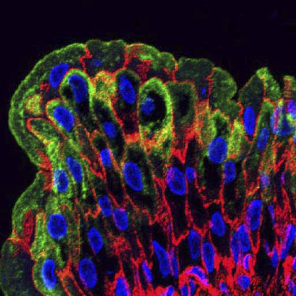 UPK3a (green), actin (red), and nuclei (blue) in bladder umbrella cells.