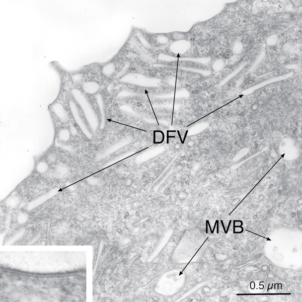 Apical surface of umbrella cell showing discoidal- and/or fusiform-shaped vesicles (DFVs) and multi vesicular bodies (MB). inset: asymmetric unit membrane 